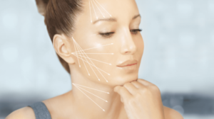 糸リフトとは？たるみやほうれい線はどうして無くなるのかを徹底解説